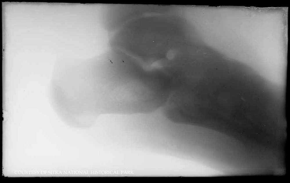 Medical image of an X-ray.