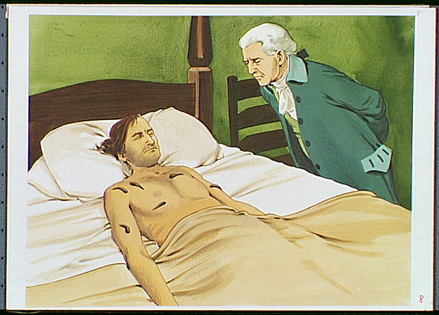 1700's (colonial) doctor bending over a man in bed with leeches applied to his upper torso. A remedy used to treat victims of Yellow Fever.